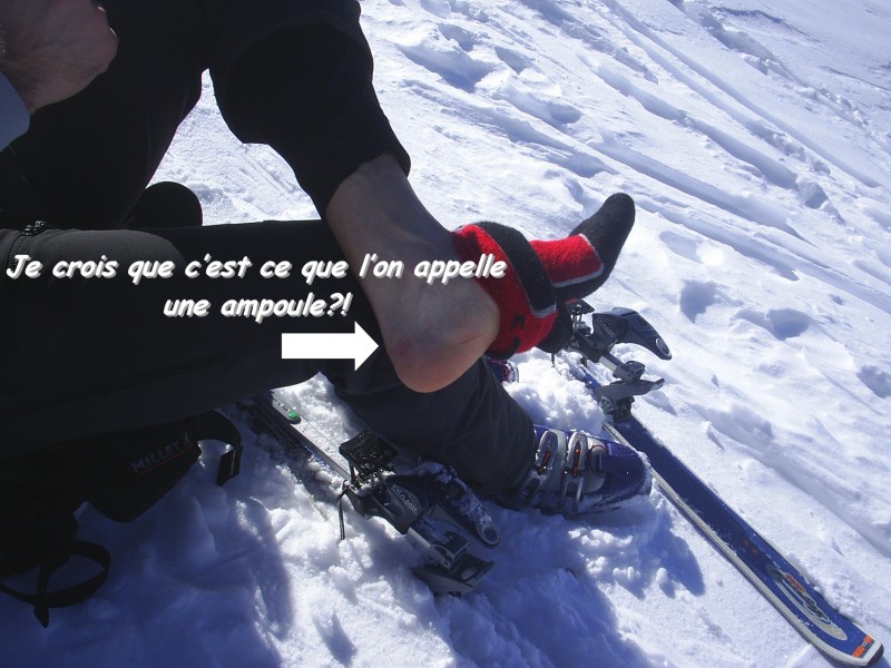 #1 Et une ampoule, une!! : Arrivée au dessus de Mery, Manu à une belle ampoule, aïe!!! Et une ampoule, une!! : Arrivée au dessus de Mery, Manu à une belle ampoule, aïe!!!