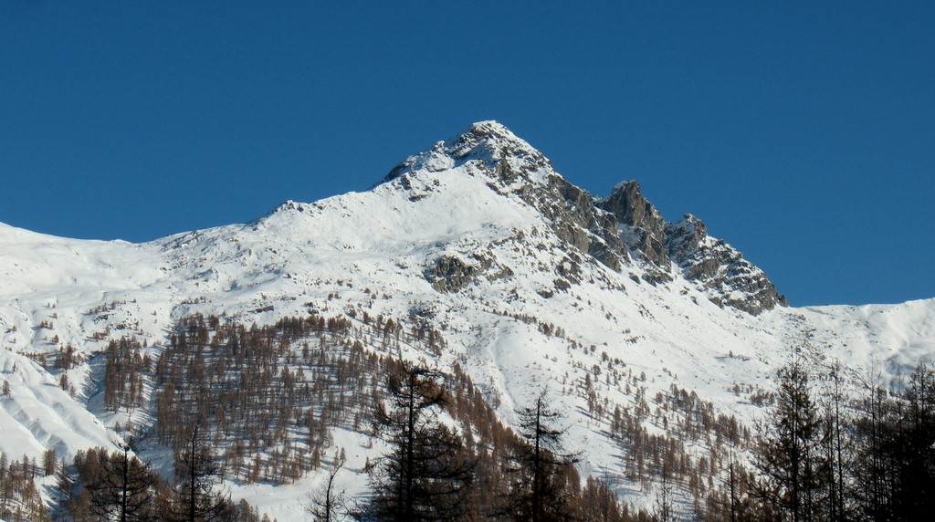 #1 Le Pelvas Le Pelvas