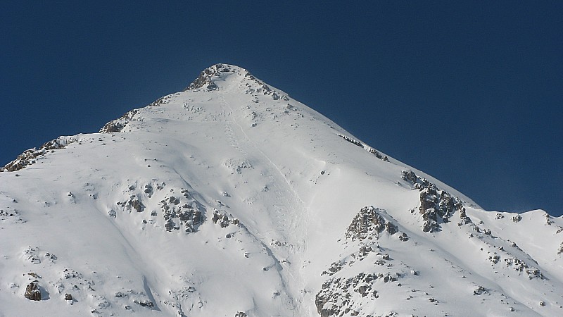 #2 haut de la face haut de la face