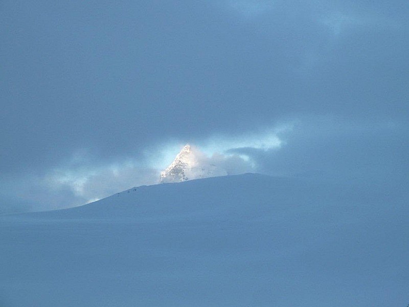 dent blanche : juste un peu