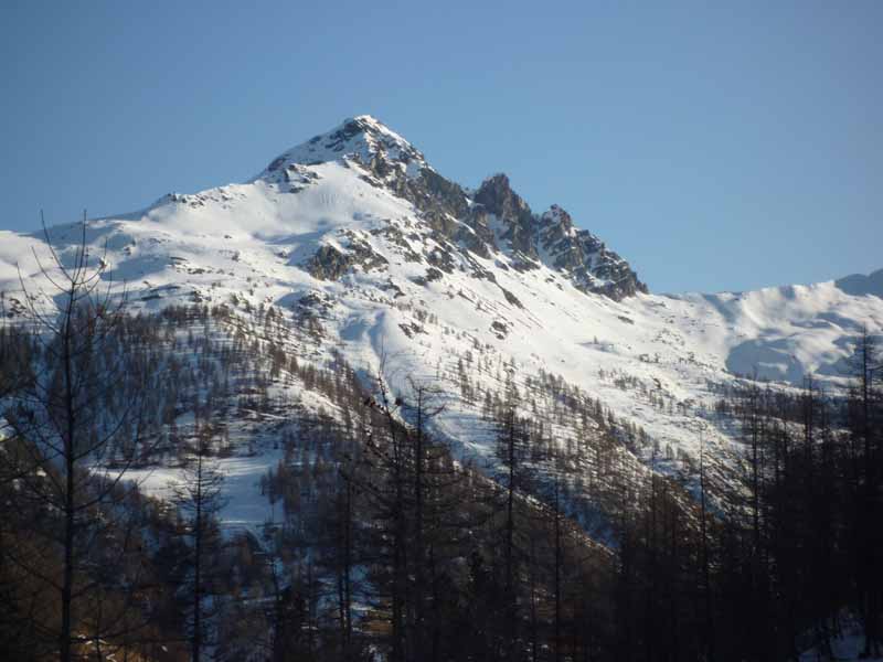 #1 vue d vue d'ensemble : Le pelvas