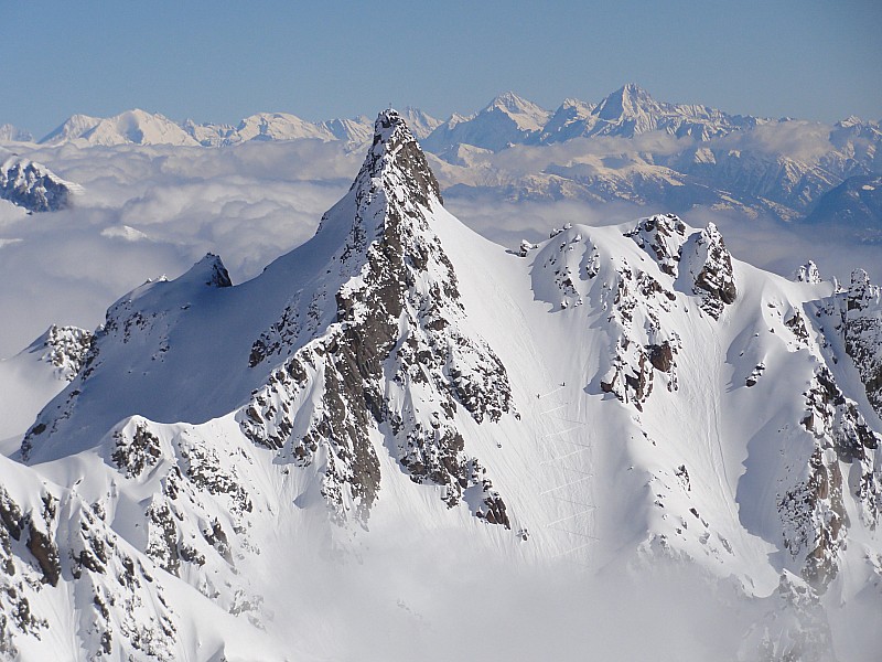 #3 Jolie dent Jolie dent