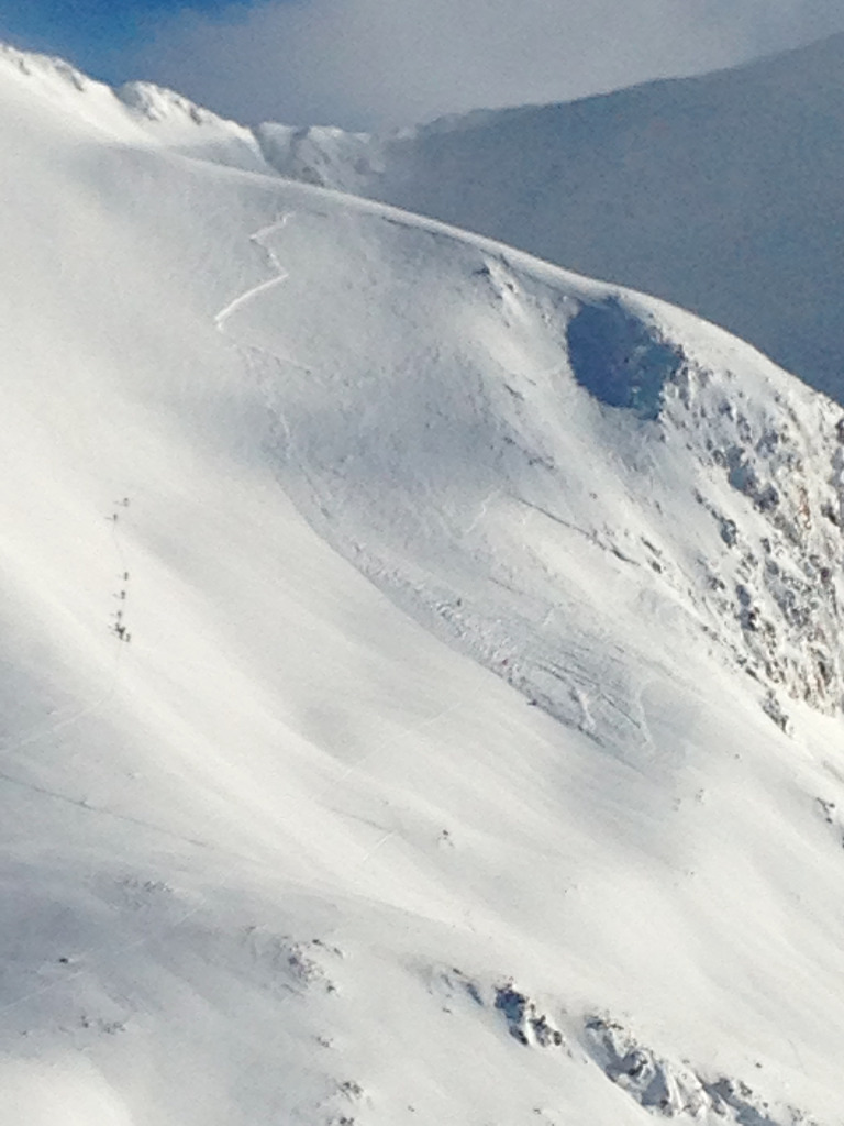 #5 15 min après
15 min après