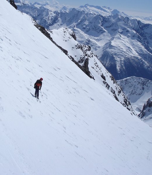 #1 Dans le haut de la face : Vincent dans le haut de la face Dans le haut de la face : Vincent dans le haut de la face
