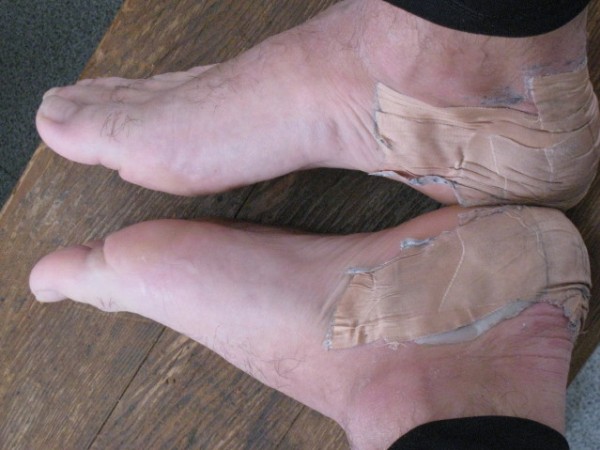 #8 Mes pieds : Pas une ampoule de la saison et voici le résultats de 2 jours en Belledonne. Une affaire de spécialiste. Mes pieds : Pas une ampoule de la saison et voici le résultats de 2 jours en Belledonne. Une affaire de spécialiste.