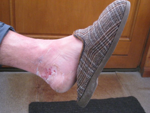 #9 Des pieds : Jean-Marc essaie de jouer dans la même catégorie ! Des pieds : Jean-Marc essaie de jouer dans la même catégorie !