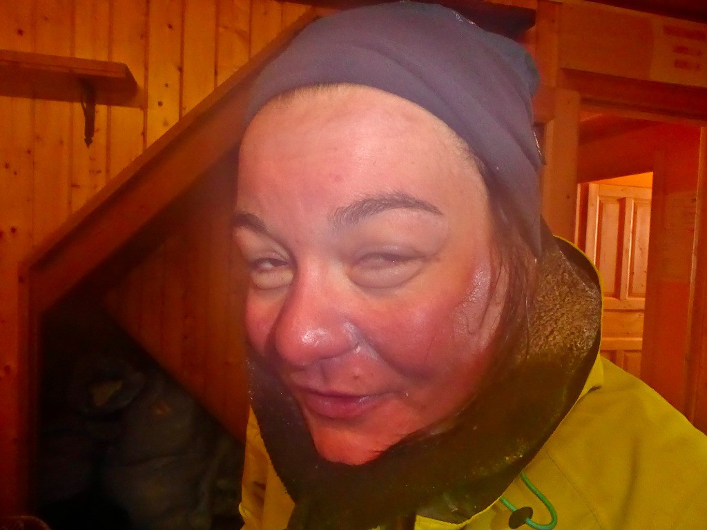 #20 La preuve qu La preuve qu'on s'est fait démonter la gueule ;)