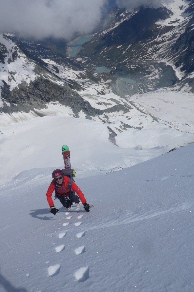 #5 Haut de la face Haut de la face