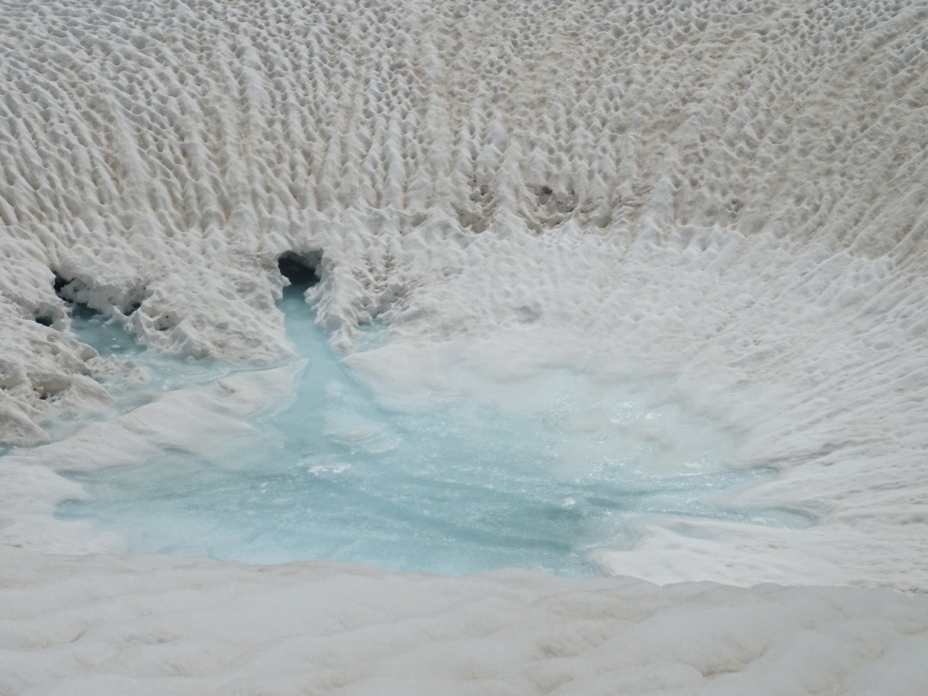 #24 Tiens, le drainage se fait d Tiens, le drainage se fait d'ici ?