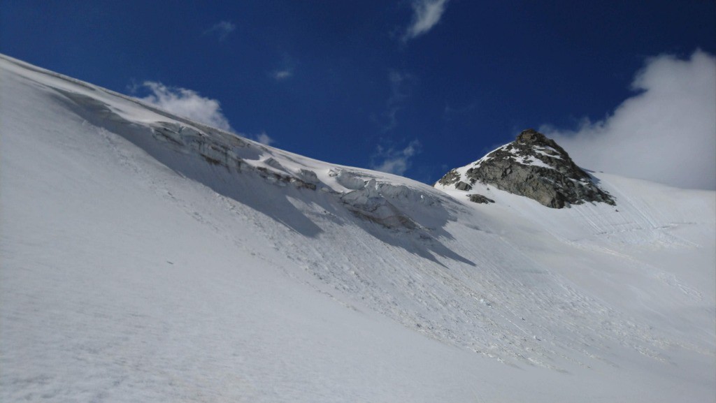 #3 Polset face Est Polset face Est